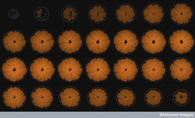 Illustration for article titled This Is How Your Fruits and Vegetables Look in an MRI Machine